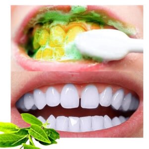 Dentifrice blanchissant